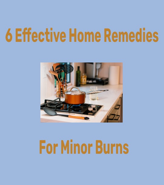 Effective home remedies for burns and sunburns